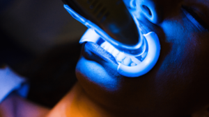 Professional laser teeth whitening procedure using blue light technology. In-office cosmetic dental treatment for a brighter, whiter smile.