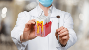 Read more about the article Why Dental Rescue Should Be Your Go-To for Root Canal Treatment (RCT) in Pakistan