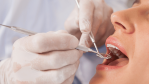 Close-up of a dentist performing dental checkup on a female patient in Lahore, Pakistan.