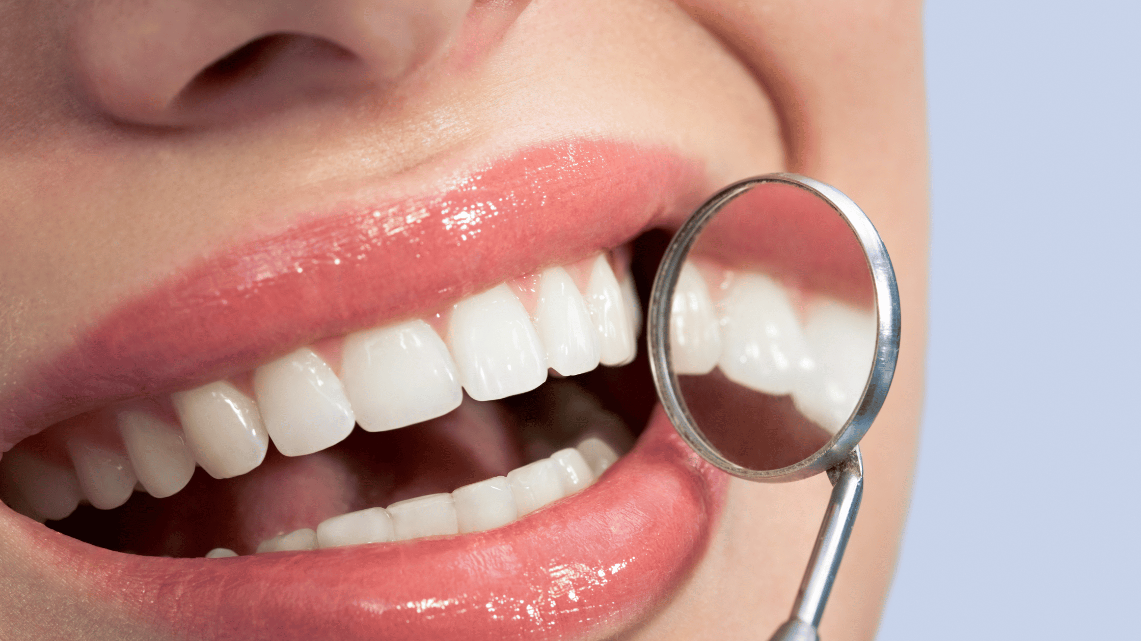 You are currently viewing Can You Whiten Teeth Naturally? What Works & What Doesn’t