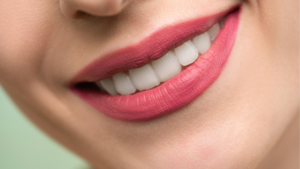 Read more about the article Why Lahore Residents Are Choosing Dental Rescue for Smile Makeovers